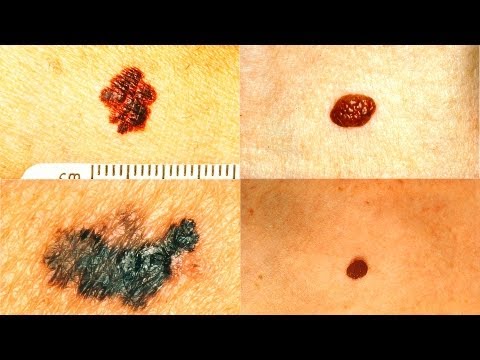 Soda bilang isang paraan ng slimming Mga larawan para sa pagganyak sa mawala ang timbang