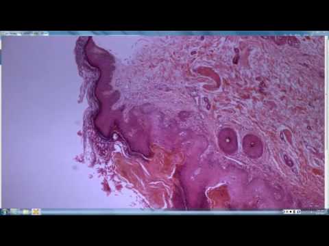 2016 2017 Elston Dermpath Ch 19