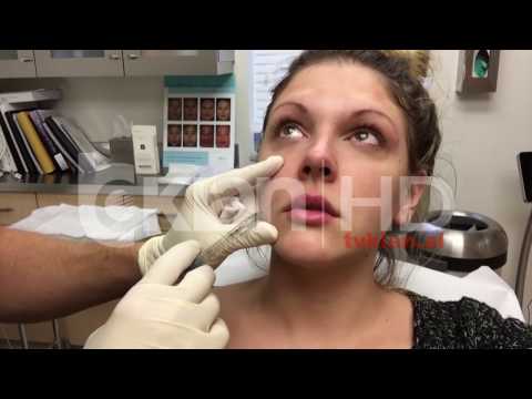 Rreziku nga produktet kozmetike