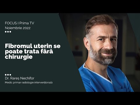 Fibromul uterin se poate trata fără chirurgie I Dr. Rareș Nechifor