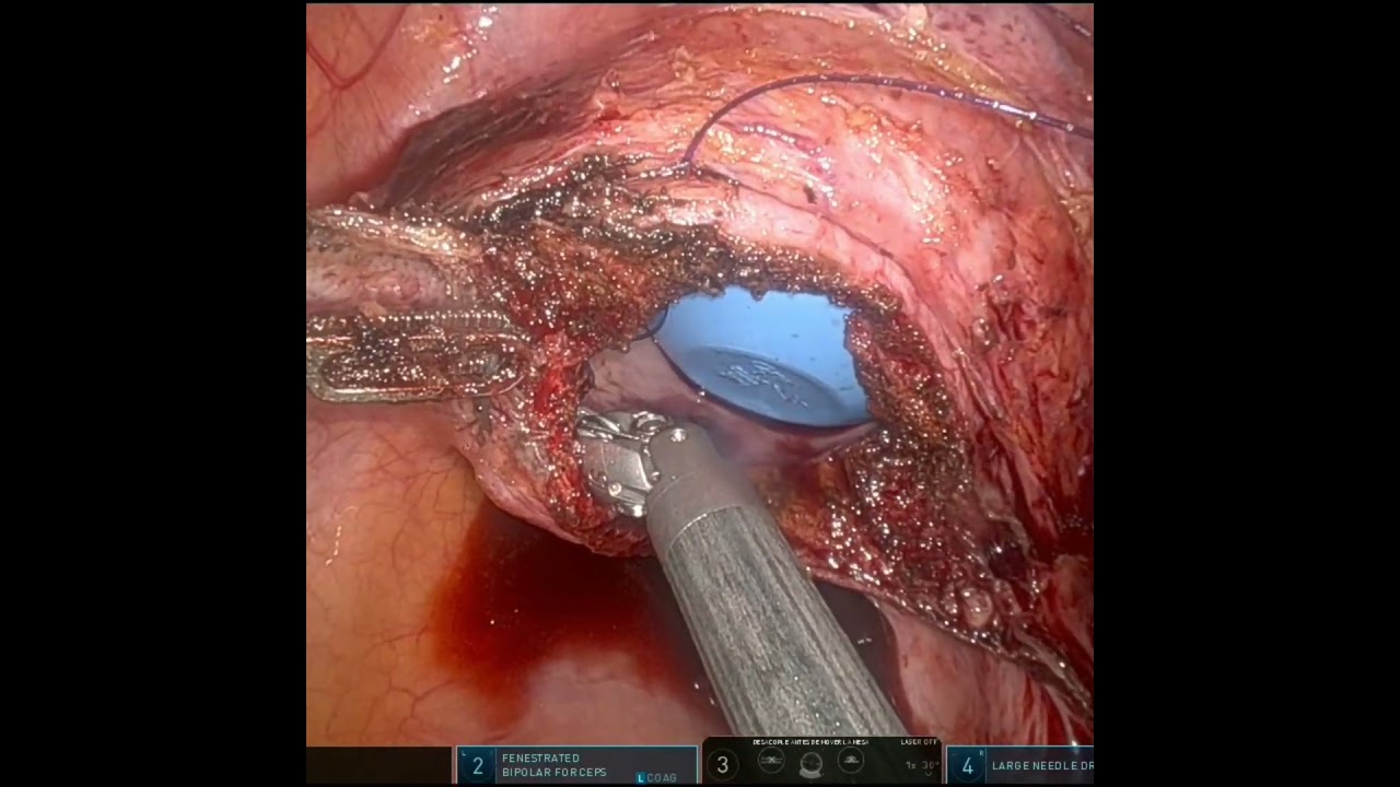 Ángel Millán Juárez-103