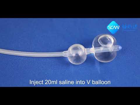 Induction With Balloon | How To Use Cervical Ripening Balloon | SCW Medicath