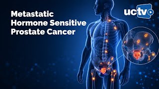 Metastatic Hormone Sensitive Prostate Cancer