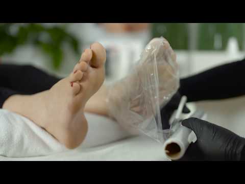 MAVEX® Calluspeeling: nowoczesny zabieg pedicure w 15 minut!