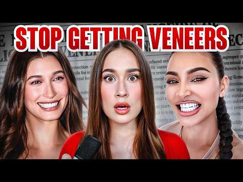 VENEERS ARE RUINING YOUR FACE (scientifically proven)