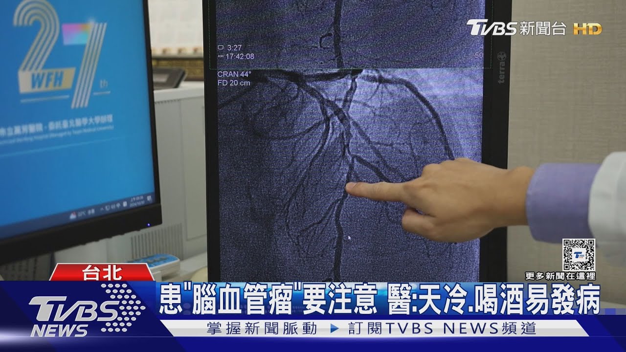 尾牙續攤突倒地 男因「腦血管瘤」破裂不治