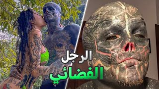 أغرب عملية تجميل في العالم Anthony Loffredo