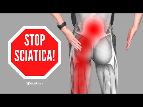 Alleviate Sciatic Back and Leg Pain in 10 Minutes