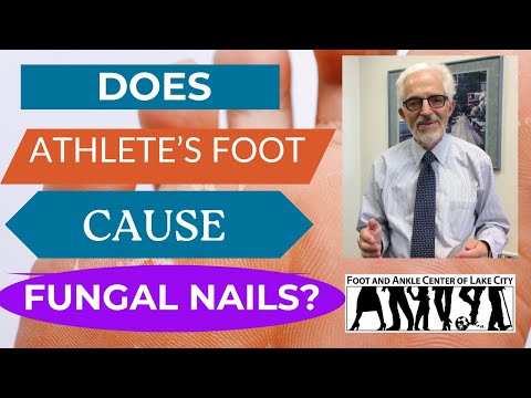 Does Athlete's Foot Cause Fungal Toenails?