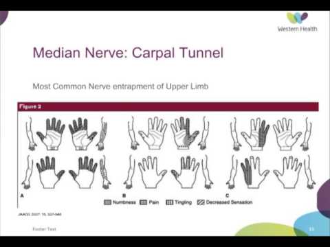 Nerve Entrapment: Upper Limb by Dr Peter Moore