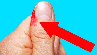 What a Hangnail Actually Feels Like
