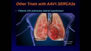 Gene Therapy for Heart Failure