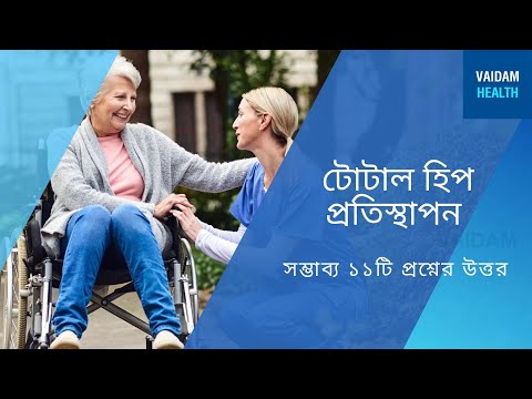 সম্পূর্ণ হিপ প্রতিস্থাপন- প্রায়শই জিজ্ঞাসিত প্রশ্ন