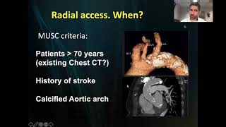 Role of Transradial Access in interventional Oncology - Marcelo Guimaraes