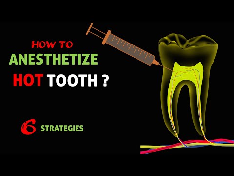 How to Anesthetize Hot Tooth