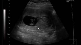 Liefde Voor Het Leven.wmv