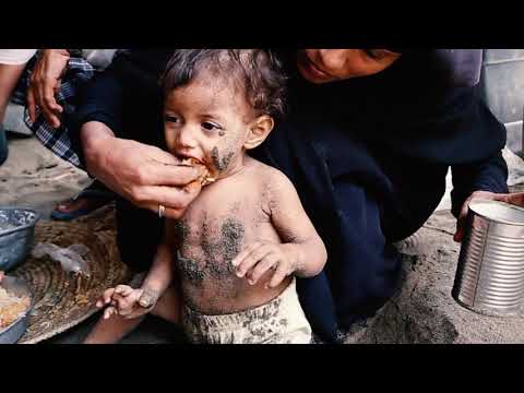 Every year, 3 million children die of hunger. Help us save them.