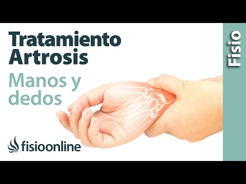 Az arthrosis rehabilitációja Dorsenval artrosis kezelése