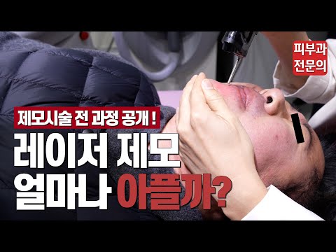 아프니까 제모다. 제모 레이저 시술하는데 얼마나 걸리고, 얼마나 아플까? 실제 제모레이저 전 과정 공개!