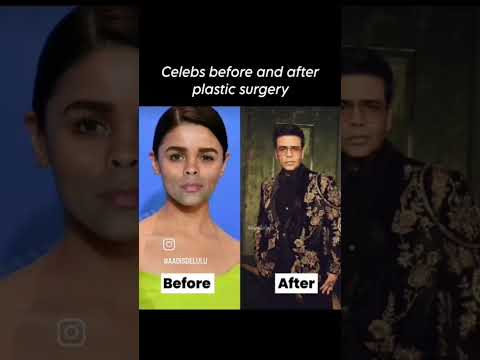 power of plastic surgery #shorts #salmankhan