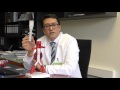 Bauchaorten Aneurysma Dr Med Ahmed Koshty