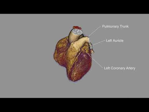 Good 4d Heart
