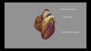 4D Heart Video