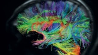 Know your Brain :Capgras Syndrome, Phantom Limb, Synesthesia (gr Subs)