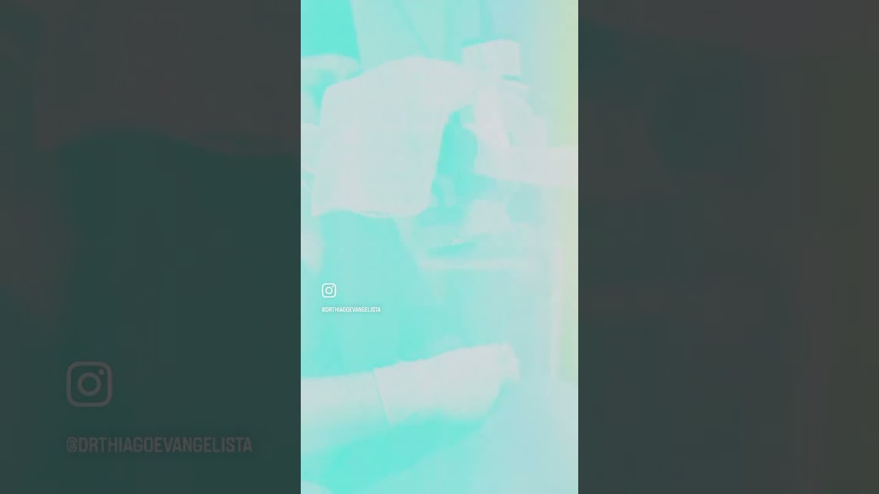 Rotina cirúrgica de Pterígio!