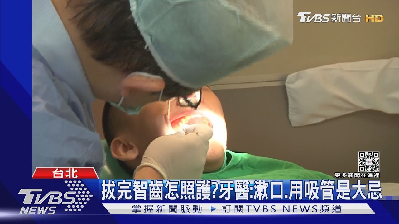 「黃氏兄弟瑋瑋」拔完智齒隔天爆血!牙醫曝2禁忌千萬別做