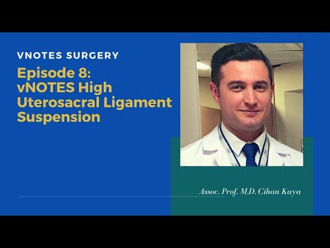 vNOTES High USLS