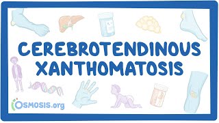 Cerebrotendinous Xanthomatosis (NORD)