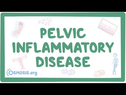 Pelvic inflammatory disease - causes, symptoms, diagnosis, treatment, pathology