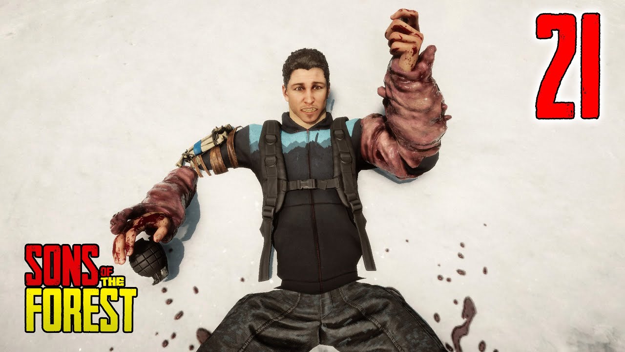 Sons Of The Forest EA S1 E21 | Anger Problems