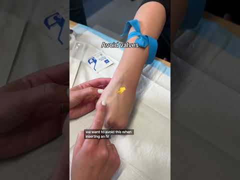 IV Start Tips 👀🩸  #RN #BSN #futurenurse