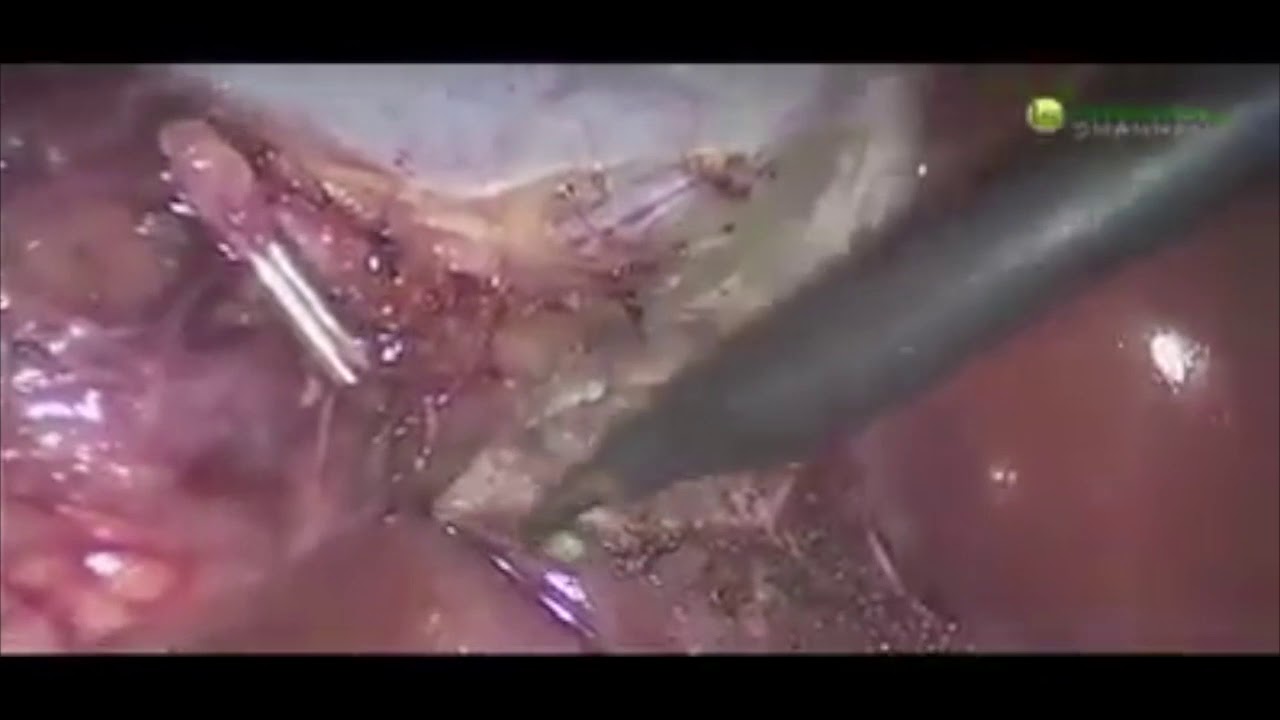 Cesar Rene Capi Rizo-13