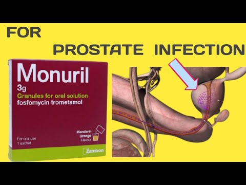 Prostatitis tramel
