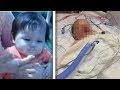 Flash Grenade Explodes In Infant's Face | Drug ...