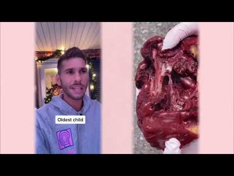#pov #foryou #funny #acting #story #foryoupage#viral #skit #fyp シ #duet #tools  #fypシ゚viral 