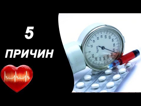 Родить после замены тазобедренного сустава Хондромаляция хряща коленного сустава как лечить