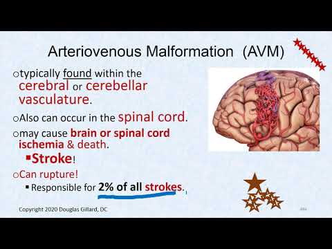 CVPP: (wk5)(thurs)(spr20): Arteriovenous Fistula, Atherosclerosis & Blood Pressure