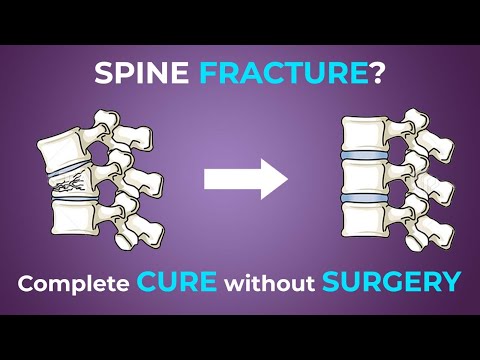 Patient Testimonials | Dr. Ajay Kothari - Spine Surgeon | Shivaji Nagar, Pune