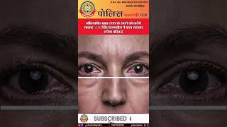 🔴मोतियाबिंद मुक्त राज्य के सपने को करेंगे साकार,CM देवेंद्र फडणवीस ने कहा सरकार हमेशा प्रतिबद्ध