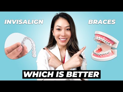 Invisalign vs. Braces