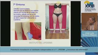 LIPEDEMA, Conocemos esta enfermedad