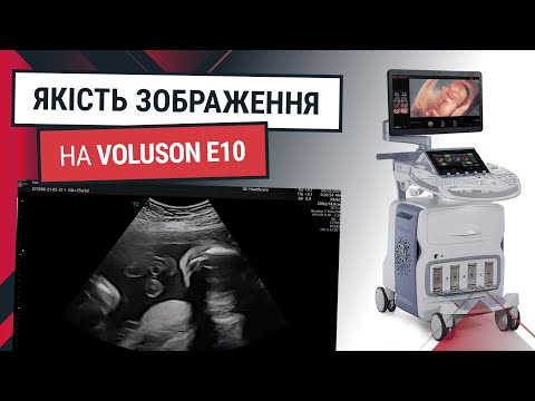 Якість зображення на GE Voluson E10 - Статті RH