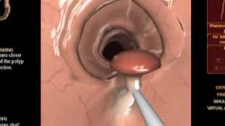 Routine Miracles with Dr. Conrad Fischer: Gastroenterology