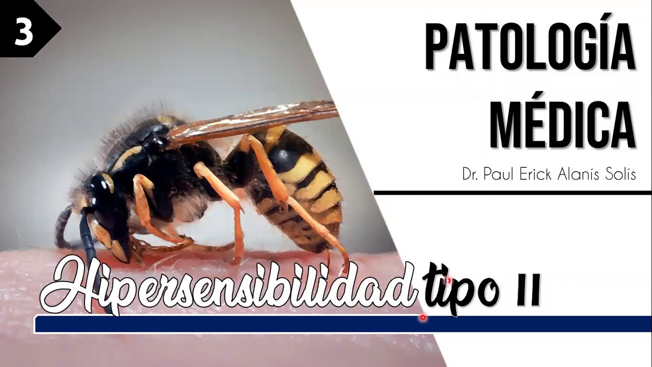 Hipersensibilidad tipo II