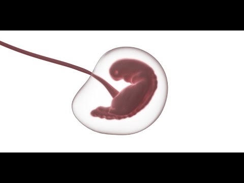 Jak leczyć guzki w palucha Koślawego PLUS