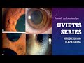 UVEITIS SERIES  Classification, Types and Pathology of Uveitis